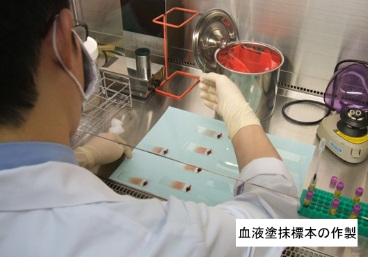 血液塗抹標本の作製