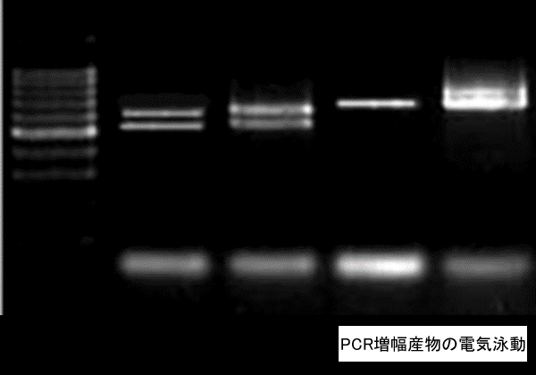 PCR増幅産物の電気泳動